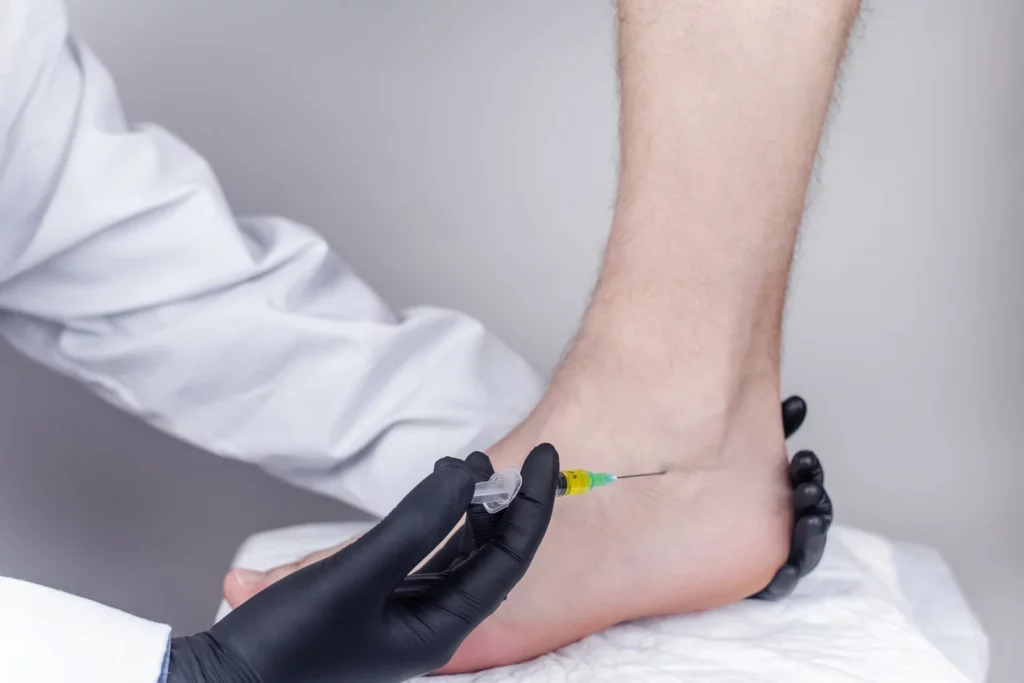 PRP Injections for Plantar Fasciitis and Achilles Tendinitis